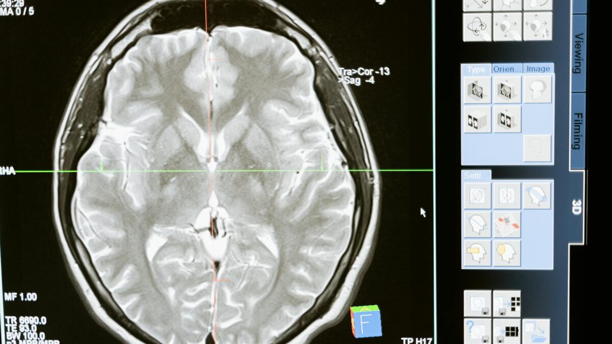 Science Corp’s Groundbreaking Brain Sensor Trial Set to Begin Soon